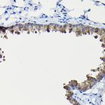 FUCA2 Antibody in Immunohistochemistry (Paraffin) (IHC (P))