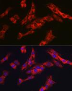 G6PC3 Antibody in Immunocytochemistry (ICC/IF)