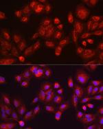 GALC Antibody in Immunocytochemistry (ICC/IF)