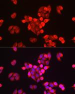 GALC Antibody in Immunocytochemistry (ICC/IF)