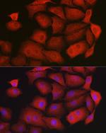 GAMT Antibody in Immunocytochemistry (ICC/IF)