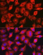 GAMT Antibody in Immunocytochemistry (ICC/IF)