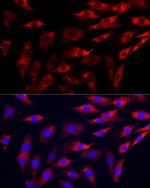 GAMT Antibody in Immunocytochemistry (ICC/IF)