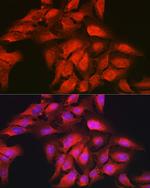 GAMT Antibody in Immunocytochemistry (ICC/IF)