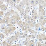 GAMT Antibody in Immunohistochemistry (Paraffin) (IHC (P))