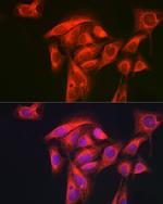 GART Antibody in Immunocytochemistry (ICC/IF)