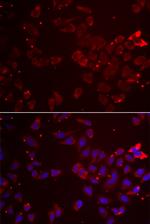 GATM Antibody in Immunocytochemistry (ICC/IF)