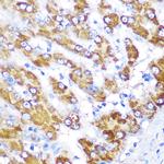 GATM Antibody in Immunohistochemistry (Paraffin) (IHC (P))