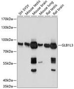 GLB1L3 Antibody in Western Blot (WB)