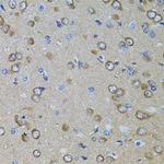 PRAMEF20 Antibody in Immunohistochemistry (Paraffin) (IHC (P))