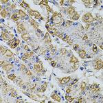 PRAMEF20 Antibody in Immunohistochemistry (Paraffin) (IHC (P))