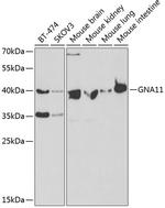 GNA11 Antibody in Western Blot (WB)