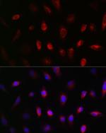 GNB3 Antibody in Immunocytochemistry (ICC/IF)