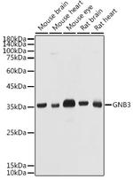 GNB3 Antibody in Western Blot (WB)