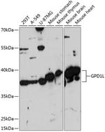 GPD1L Antibody in Western Blot (WB)