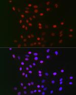 GPS1 Antibody in Immunocytochemistry (ICC/IF)