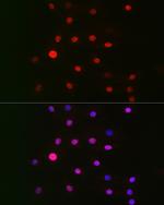 GPS1 Antibody in Immunocytochemistry (ICC/IF)