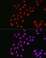 GPS1 Antibody in Immunocytochemistry (ICC/IF)