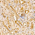 GPS1 Antibody in Immunohistochemistry (Paraffin) (IHC (P))