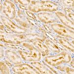 GPS1 Antibody in Immunohistochemistry (Paraffin) (IHC (P))