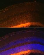 GRK1 Antibody in Immunohistochemistry (Paraffin) (IHC (P))