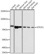 GTF2F1 Antibody in Western Blot (WB)