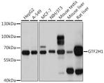 GTF2H1 Antibody in Western Blot (WB)