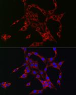 HBEGF Antibody in Immunocytochemistry (ICC/IF)