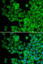 HCK Antibody in Immunocytochemistry (ICC/IF)