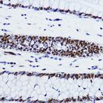 H2BK12ac Antibody in Immunohistochemistry (Paraffin) (IHC (P))