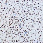 H2BK12ac Antibody in Immunohistochemistry (Paraffin) (IHC (P))