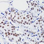 H2BK15ac Antibody in Immunohistochemistry (Paraffin) (IHC (P))