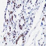 H2BK15ac Antibody in Immunohistochemistry (Paraffin) (IHC (P))