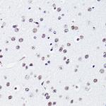 H2BK15ac Antibody in Immunohistochemistry (Paraffin) (IHC (P))