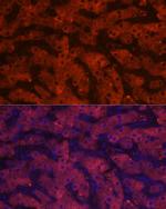 HSD17B13 Antibody in Immunocytochemistry (ICC/IF)