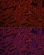 HSD17B13 Antibody in Immunocytochemistry (ICC/IF)