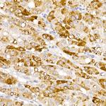 HSD17B13 Antibody in Immunohistochemistry (Paraffin) (IHC (P))