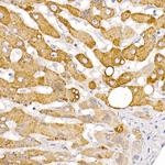 HSD17B13 Antibody in Immunohistochemistry (Paraffin) (IHC (P))