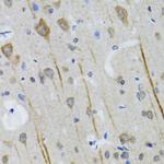 HTR3A Antibody in Immunohistochemistry (Paraffin) (IHC (P))