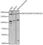 HYOU1 Antibody in Western Blot (WB)