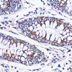 ICA1 Antibody in Immunohistochemistry (Paraffin) (IHC (P))