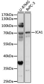 ICA1 Antibody in Western Blot (WB)