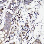 IL6R Antibody in Immunohistochemistry (Paraffin) (IHC (P))