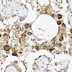 IL6R Antibody in Immunohistochemistry (Paraffin) (IHC (P))