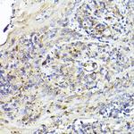 IL6R Antibody in Immunohistochemistry (Paraffin) (IHC (P))