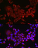 Activin A Antibody in Immunocytochemistry (ICC/IF)