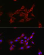 Activin A Antibody in Immunocytochemistry (ICC/IF)