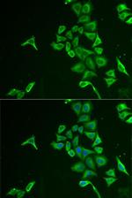 INPP5J Antibody in Immunocytochemistry (ICC/IF)