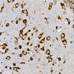 INSIG2 Antibody in Immunohistochemistry (Paraffin) (IHC (P))