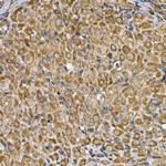 INSIG2 Antibody in Immunohistochemistry (Paraffin) (IHC (P))